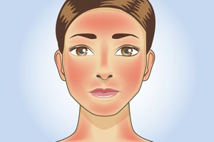 Benefits of Zinc Oxide - Swollen red skin